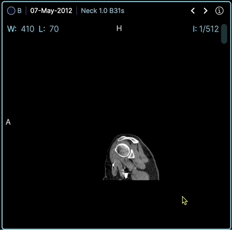 Exemple d'image DICOM lue avec OHIF Viewer